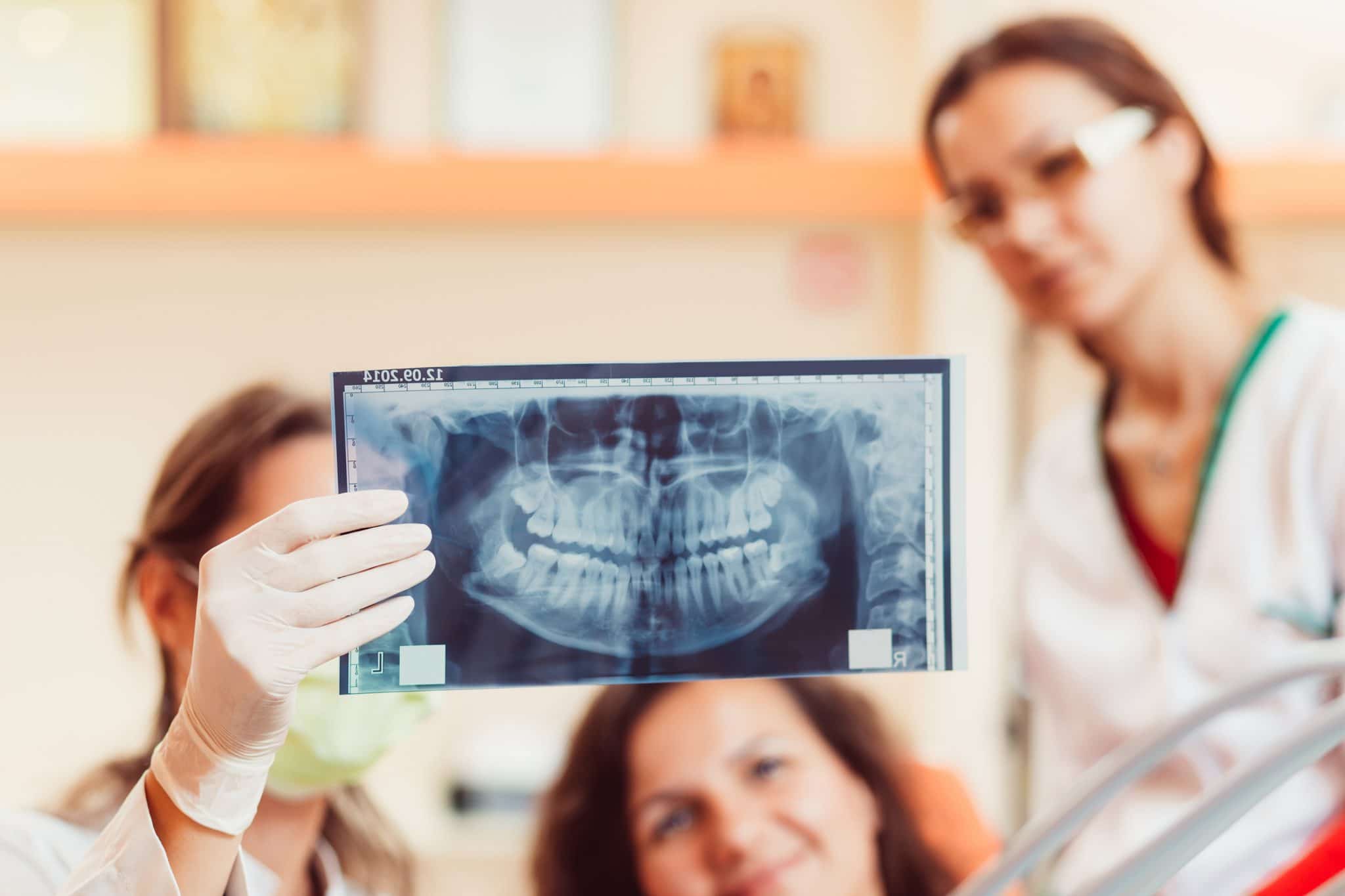 Dental X Rays X Ray Risks